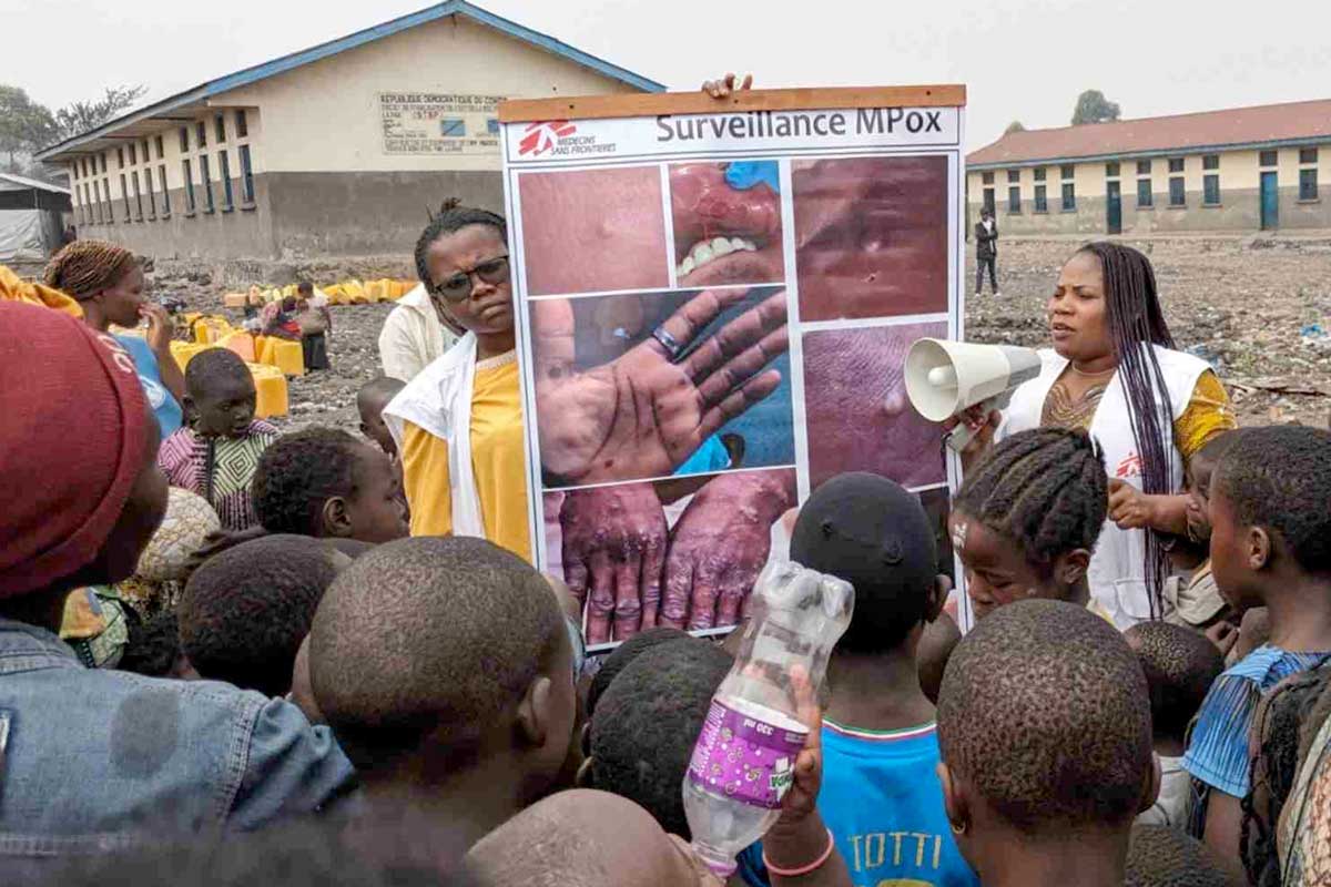 RDC : 950 cas d’épidémie Monkupox signalés au sud-kivu.