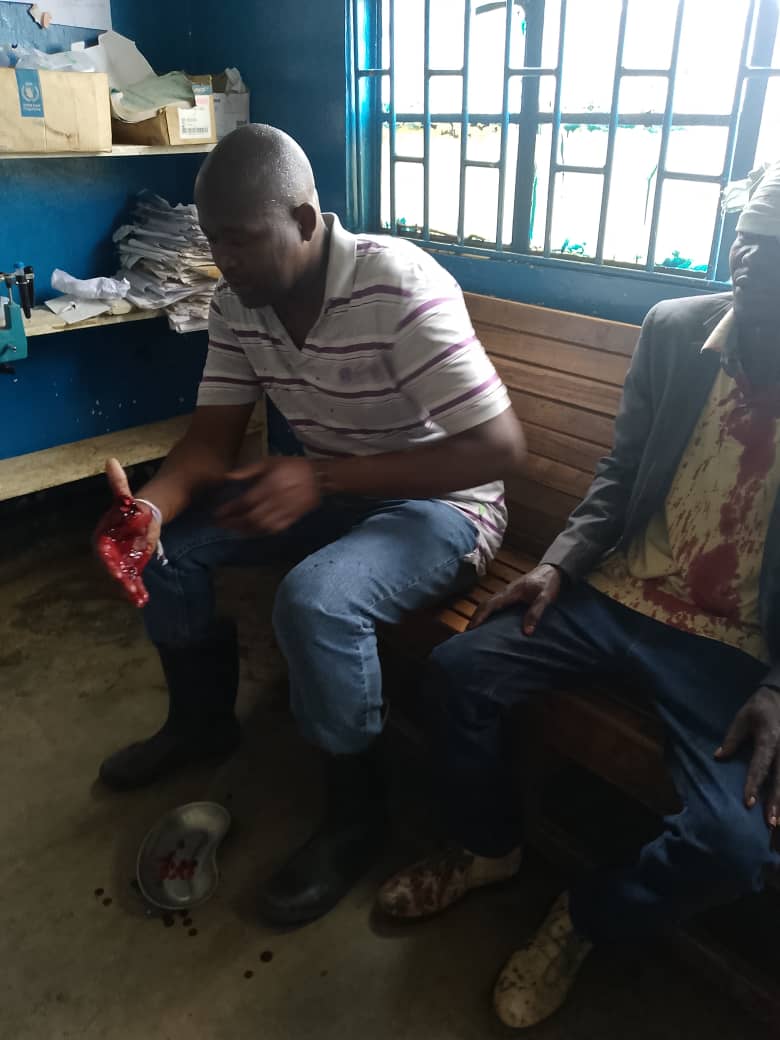 Sud-Kivu/Violences à l&rsquo;INERA Mulungu : Six blessés graves lors d&rsquo;une intervention contre la déforestation